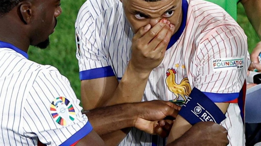 mbappe euro 2024